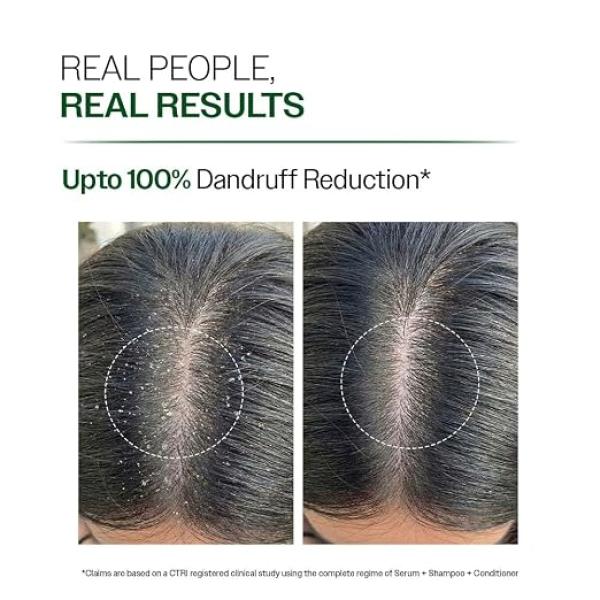 Anti-Dandruff Shampoo | Up To 100% Dandruff Reduction | 100 ml ZPTO-Free | pH 5.3 | Salicylic Acid, Piroctone Olamine & Biotin | Non-Drying Formula | For Strong, Smooth Hair | Unisex